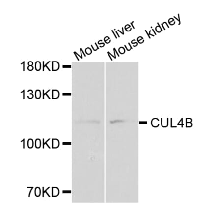 Anti-CUL4B Antibody from Bioworld Technology (BS7768) - Antibodies.com