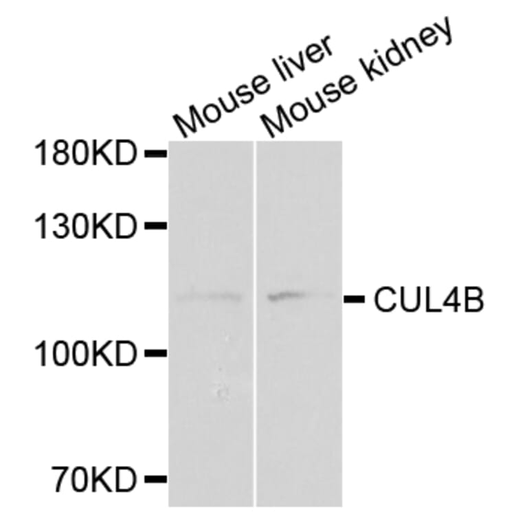 Anti-CUL4B Antibody from Bioworld Technology (BS7768) - Antibodies.com