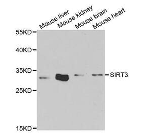 Anti-SIRT3 Antibody from Bioworld Technology (BS7772) - Antibodies.com