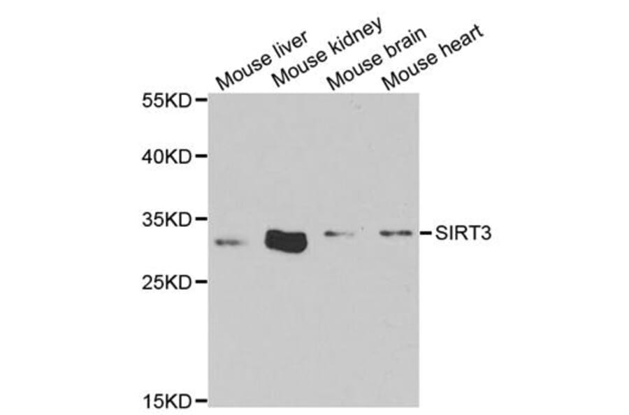 Anti-SIRT3 Antibody from Bioworld Technology (BS7772) - Antibodies.com