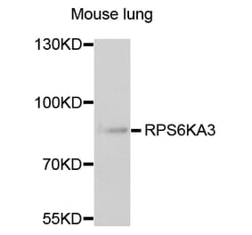 Anti-RPS6KA3 Antibody from Bioworld Technology (BS7774) - Antibodies.com