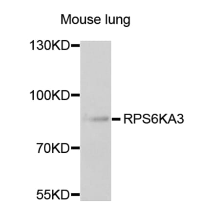 Anti-RPS6KA3 Antibody from Bioworld Technology (BS7774) - Antibodies.com