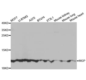 Anti-MGP Antibody from Bioworld Technology (BS7776) - Antibodies.com