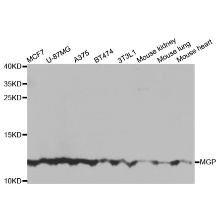 Anti-MGP Antibody from Bioworld Technology (BS7776) - Antibodies.com