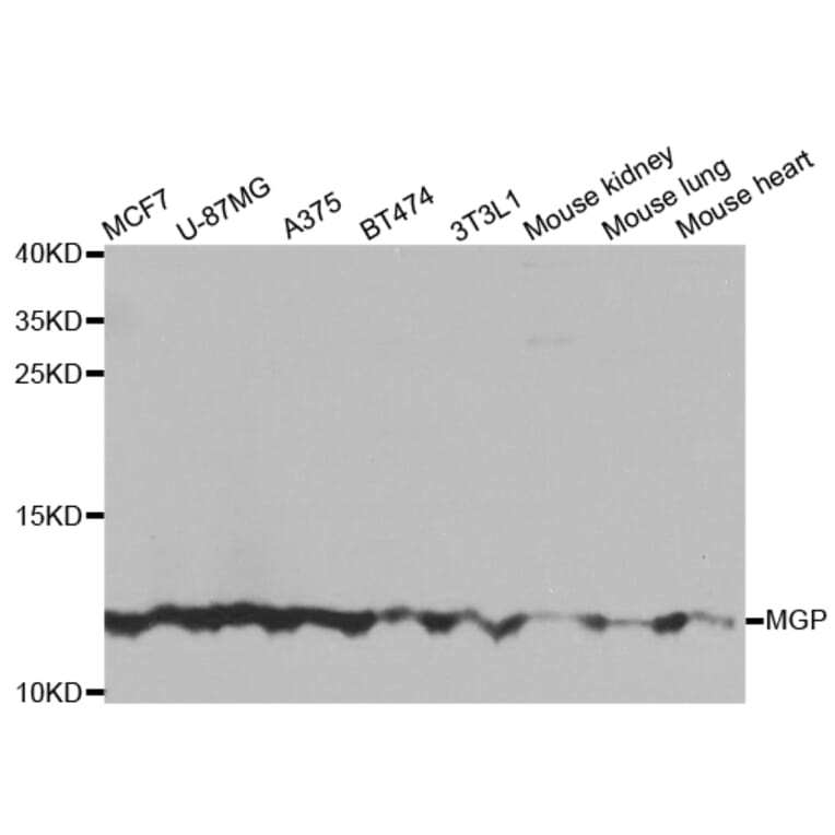 Anti-MGP Antibody from Bioworld Technology (BS7776) - Antibodies.com