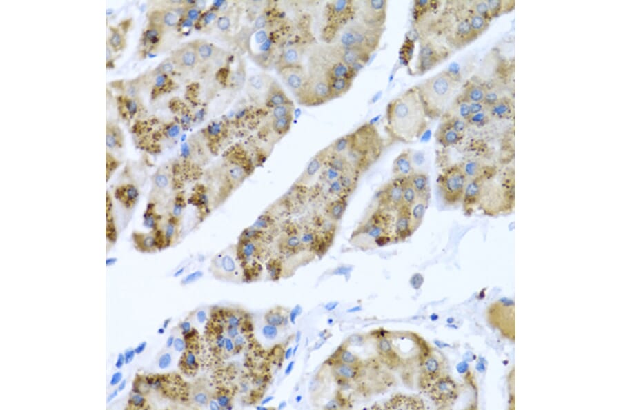 Anti-MGP Antibody from Bioworld Technology (BS7776) - Antibodies.com