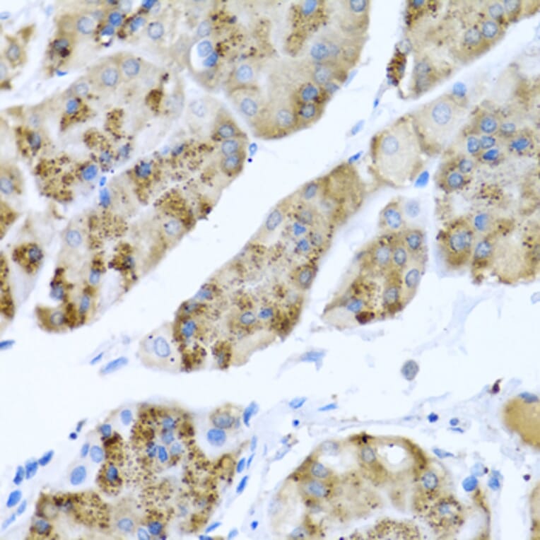 Anti-MGP Antibody from Bioworld Technology (BS7776) - Antibodies.com