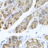 Anti-MGP Antibody from Bioworld Technology (BS7776) - Antibodies.com