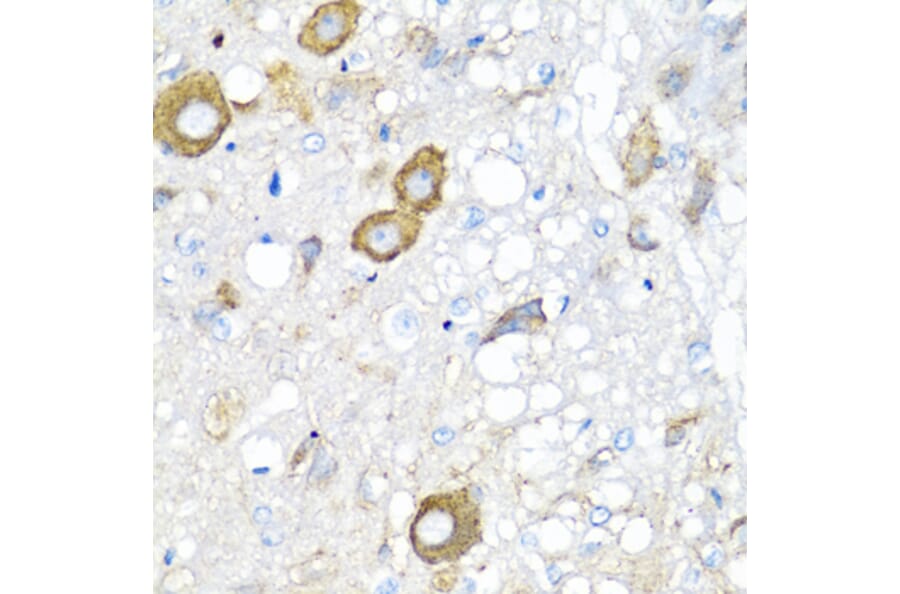 Anti-MGP Antibody from Bioworld Technology (BS7776) - Antibodies.com