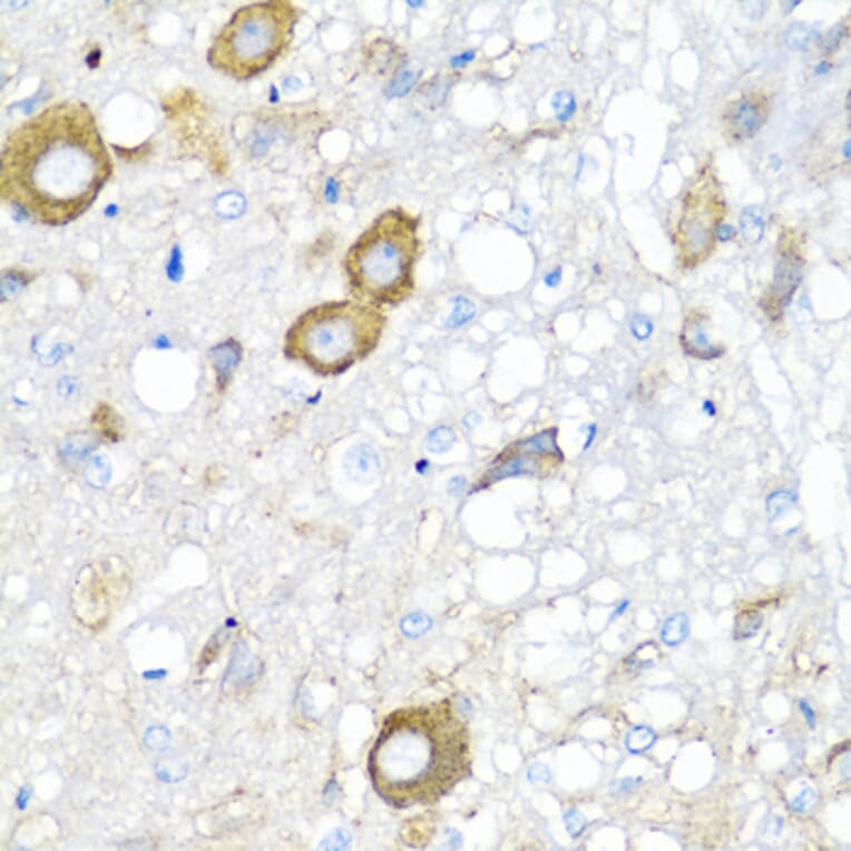 Anti-MGP Antibody from Bioworld Technology (BS7776) - Antibodies.com