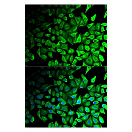 Anti-DPP7 Antibody from Bioworld Technology (BS7778) - Antibodies.com