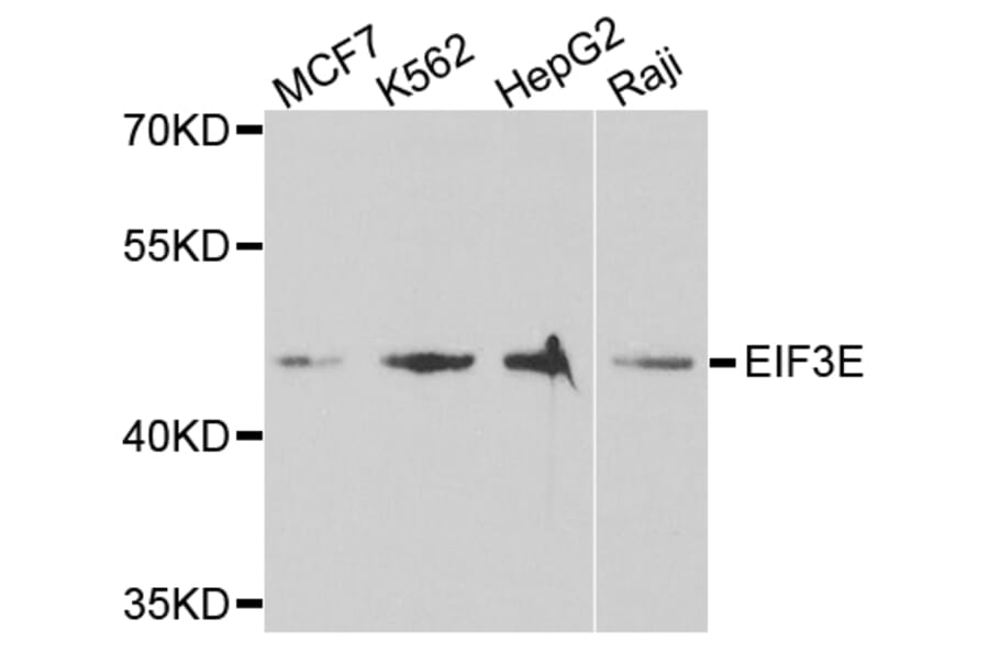 Anti-EIF3E Antibody from Bioworld Technology (BS7779) - Antibodies.com