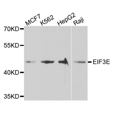 Anti-EIF3E Antibody from Bioworld Technology (BS7779) - Antibodies.com