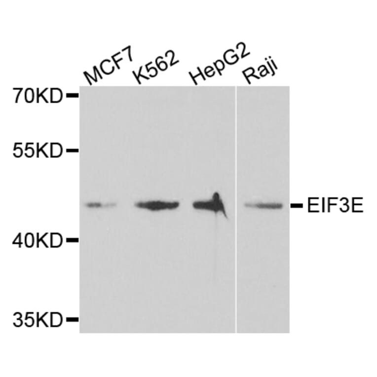 Anti-EIF3E Antibody from Bioworld Technology (BS7779) - Antibodies.com