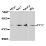 Anti-EIF3E Antibody from Bioworld Technology (BS7779) - Antibodies.com