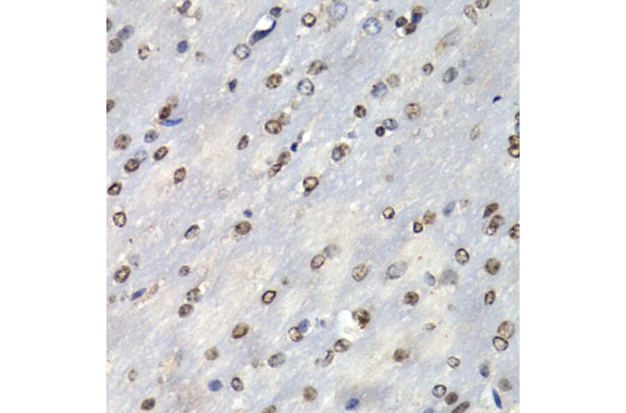 Anti-PSMB10 Antibody from Bioworld Technology (BS7781) - Antibodies.com