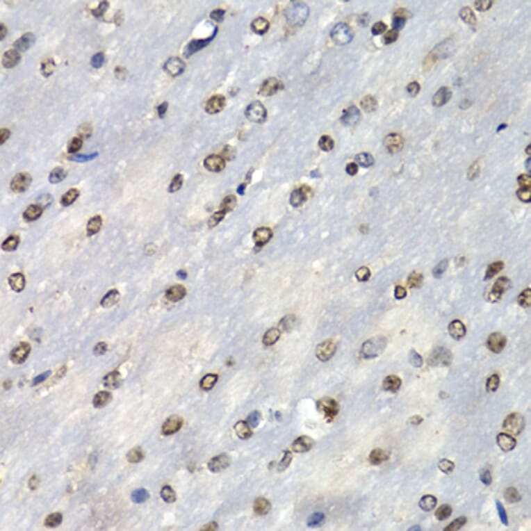Anti-PSMB10 Antibody from Bioworld Technology (BS7781) - Antibodies.com