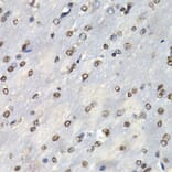 Anti-PSMB10 Antibody from Bioworld Technology (BS7781) - Antibodies.com