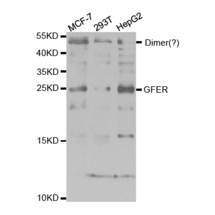 Anti-GFER Antibody from Bioworld Technology (BS7785) - Antibodies.com