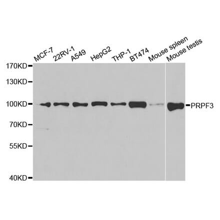 Anti-PRPF3 Antibody from Bioworld Technology (BS7788) - Antibodies.com