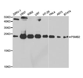 Anti-PSMB2 Antibody from Bioworld Technology (BS7789) - Antibodies.com