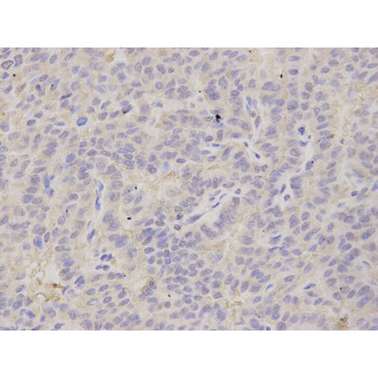 Anti-PSMB2 Antibody from Bioworld Technology (BS7789) - Antibodies.com