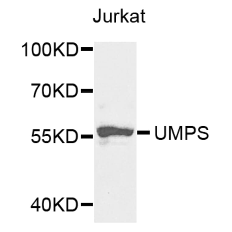 Anti-UMPS Antibody from Bioworld Technology (BS7790) - Antibodies.com