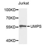 Anti-UMPS Antibody from Bioworld Technology (BS7790) - Antibodies.com