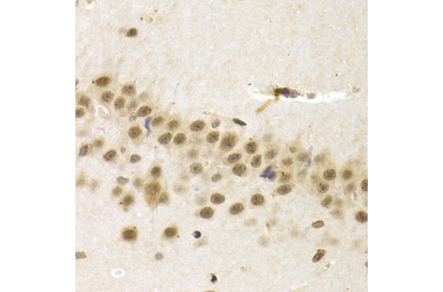 Anti-UMPS Antibody from Bioworld Technology (BS7790) - Antibodies.com