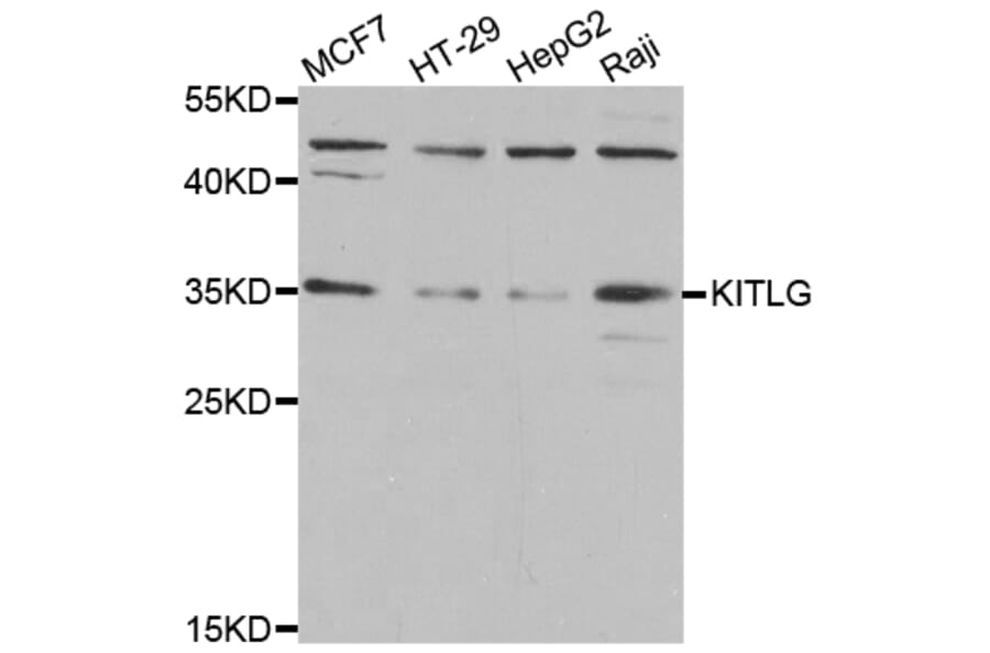 Anti-KITLG Antibody from Bioworld Technology (BS7803) - Antibodies.com
