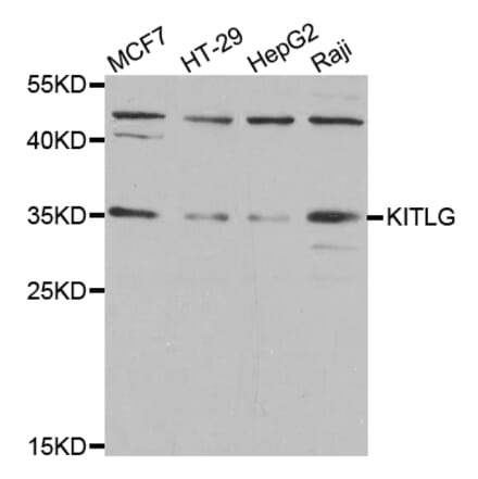 Anti-KITLG Antibody from Bioworld Technology (BS7803) - Antibodies.com