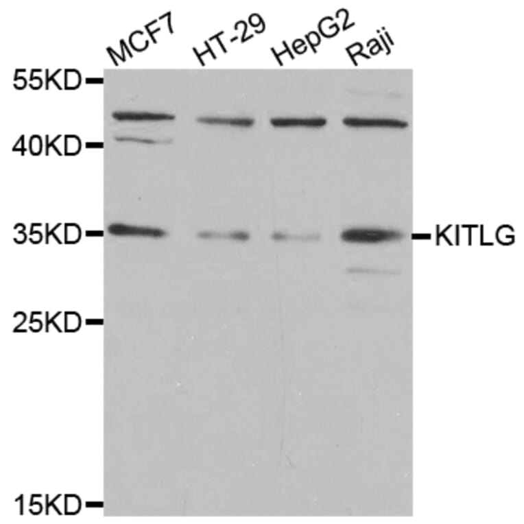 Anti-KITLG Antibody from Bioworld Technology (BS7803) - Antibodies.com