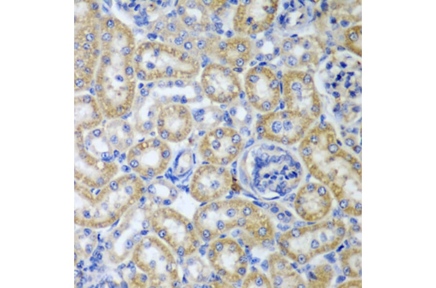 Anti-KITLG Antibody from Bioworld Technology (BS7803) - Antibodies.com
