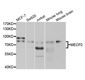 Anti-MECP2 Antibody from Bioworld Technology (BS7806) - Antibodies.com
