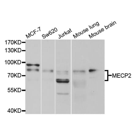 Anti-MECP2 Antibody from Bioworld Technology (BS7806) - Antibodies.com