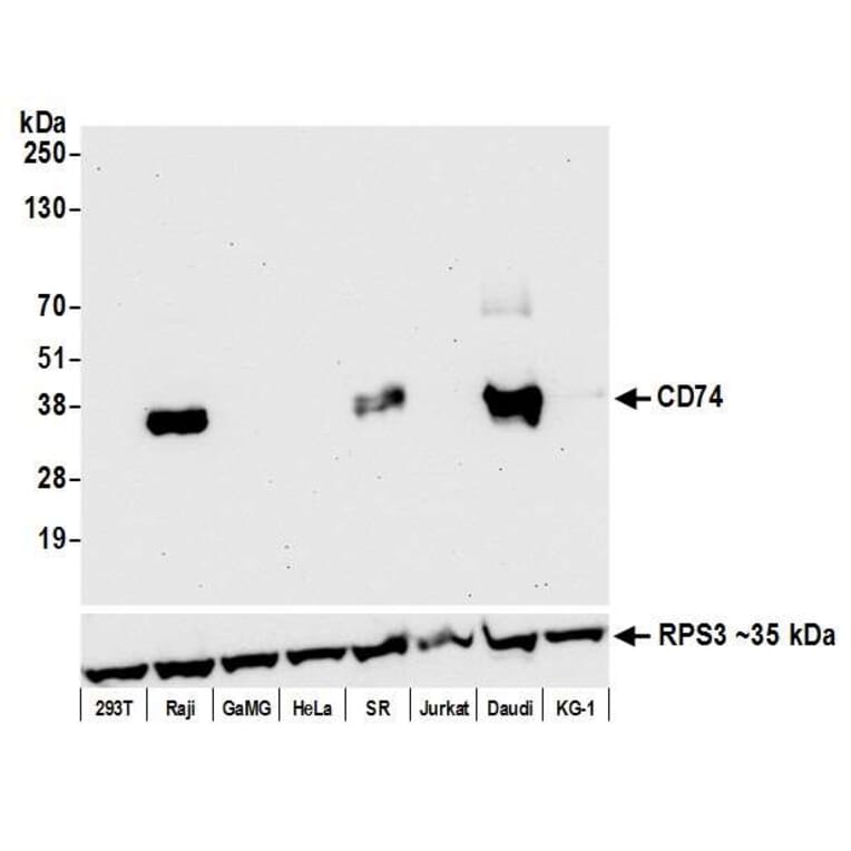 Western Blot - Anti-CD74 Antibody [LN2] (A300657) - Antibodies.com