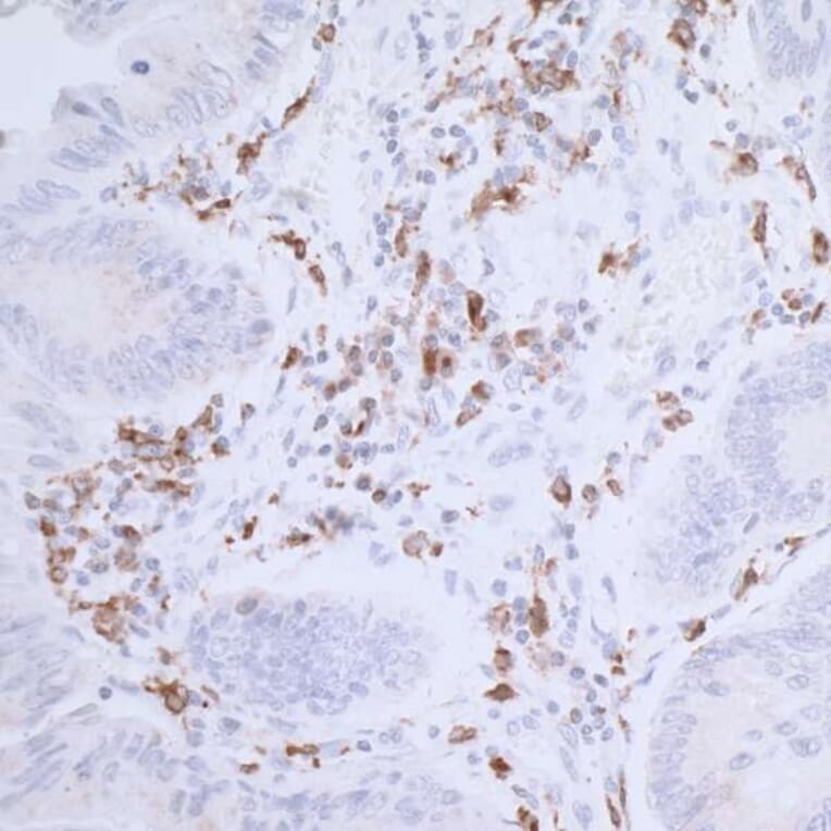 Immunohistochemistry - Anti-CD74 Antibody [LN2] (A300657) - Antibodies.com