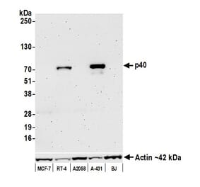 Western Blot - Anti-p40 Antibody [BC28] (A300662) - Antibodies.com