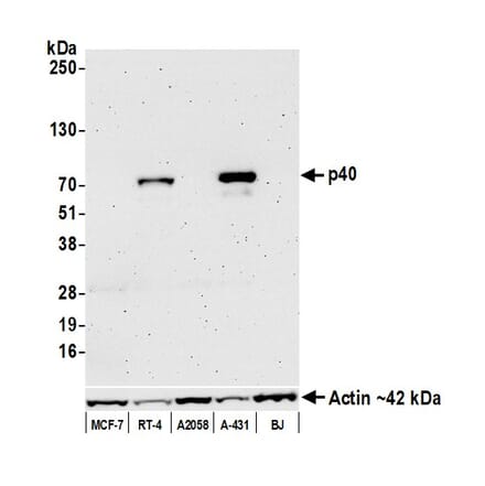 Western Blot - Anti-p40 Antibody [BC28] (A300662) - Antibodies.com