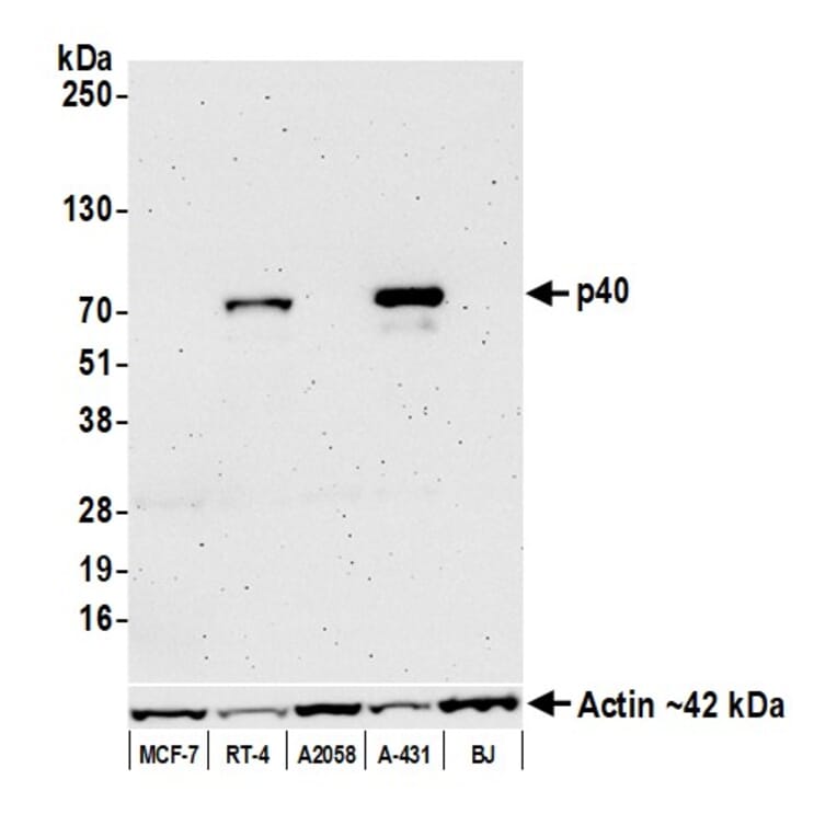 Western Blot - Anti-p40 Antibody [BC28] (A300662) - Antibodies.com