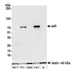 Western Blot - Anti-p40 Antibody [BC28] (A300662) - Antibodies.com