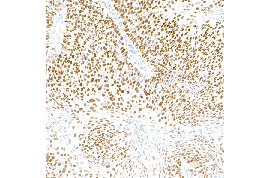 Immunohistochemistry - Anti-p40 Antibody [BC28] (A300662) - Antibodies.com