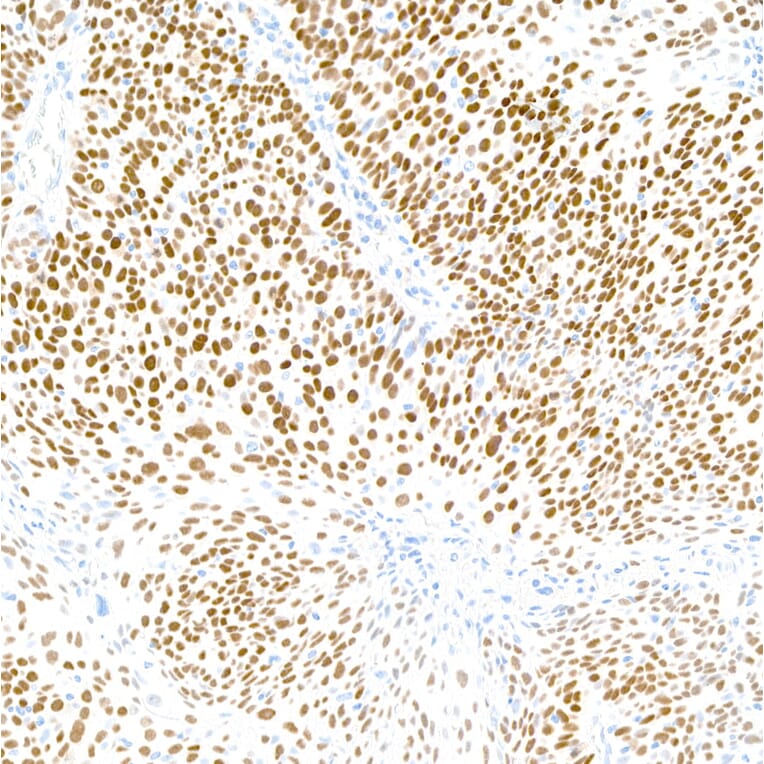 Immunohistochemistry - Anti-p40 Antibody [BC28] (A300662) - Antibodies.com