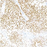 Immunohistochemistry - Anti-p40 Antibody [BC28] (A300662) - Antibodies.com