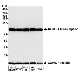 Western Blot - Anti-ATP1A1 Antibody [464.6] (A300665) - Antibodies.com