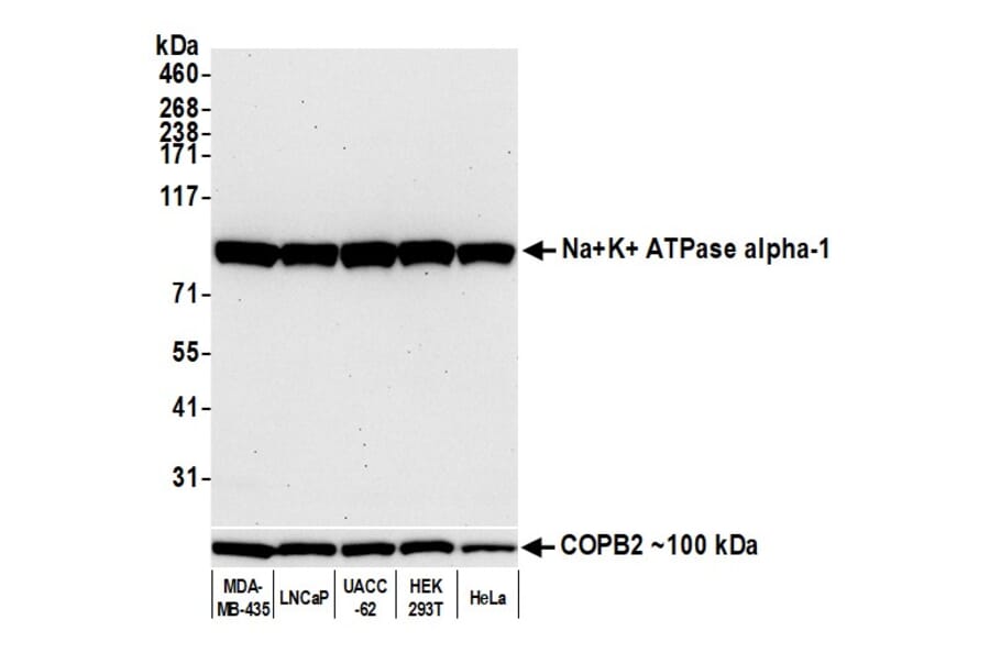 Western Blot - Anti-ATP1A1 Antibody [464.6] (A300665) - Antibodies.com