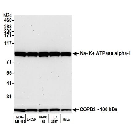 Western Blot - Anti-ATP1A1 Antibody [464.6] (A300665) - Antibodies.com