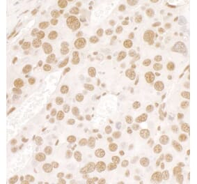 Immunohistochemistry - Anti-TLS / FUS Antibody (A301797) - Antibodies.com