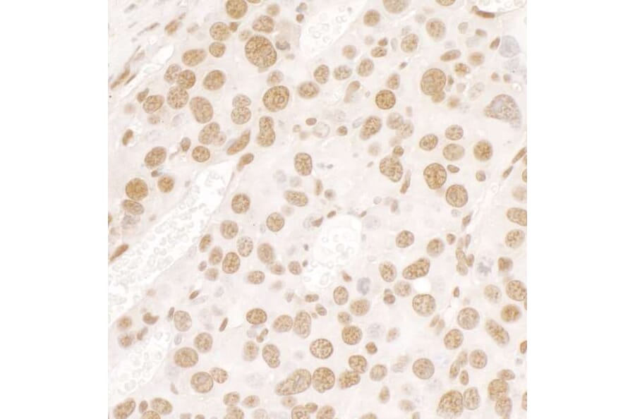 Immunohistochemistry - Anti-TLS / FUS Antibody (A301797) - Antibodies.com