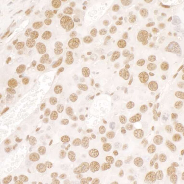 Immunohistochemistry - Anti-TLS / FUS Antibody (A301797) - Antibodies.com